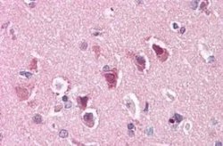ENT1 Antibody, Novus Biologicals 50 &mu;g; Unconjugated:Antibodies, Polyclonal
